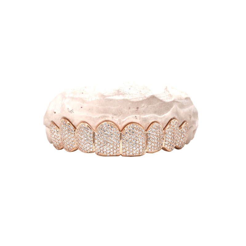 Fully Iced Diamond Grill (14K ROSE GOLD) - IF & Co. Custom Jewelers