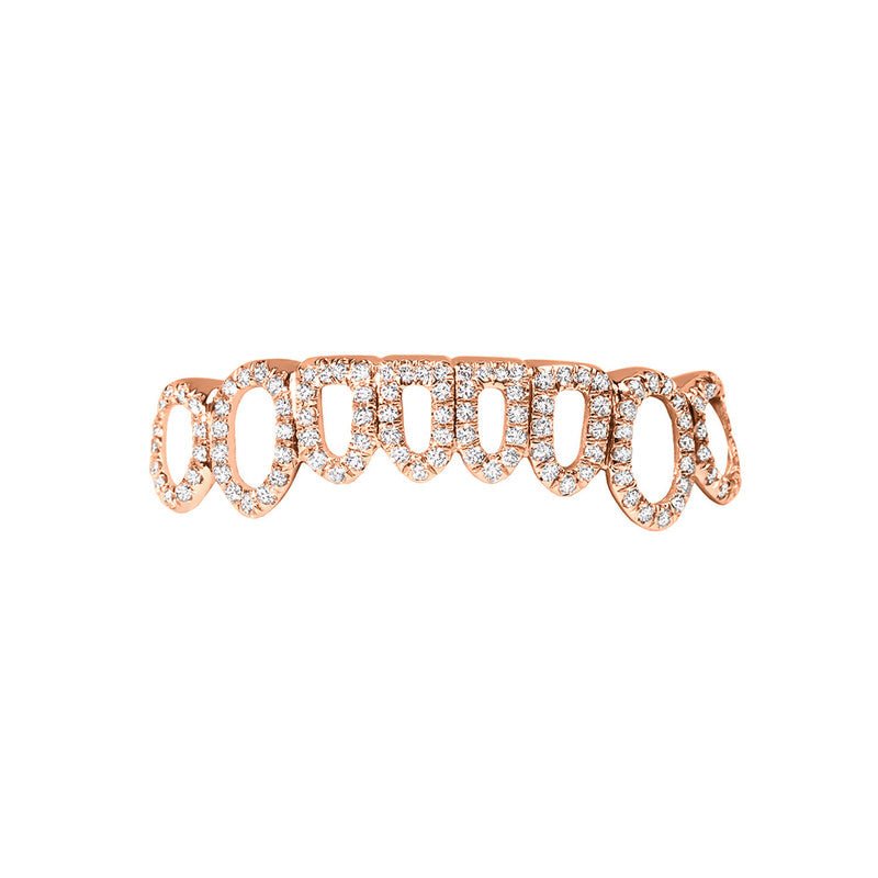 Open Face Diamond Grill (14K ROSE GOLD) - IF & Co. Custom Jewelers