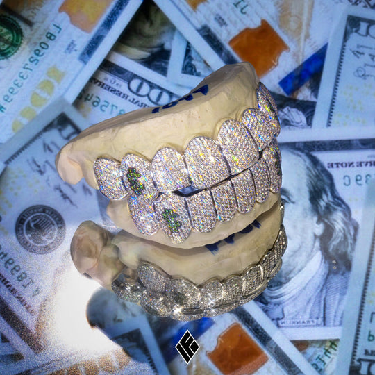 CUSTOMIZED FULLY ICED OUT DIAMOND GRILLS (FULL SET)
