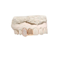 Grills - Diamond Grill Cap (Partially Iced, Double) - ifandco.com