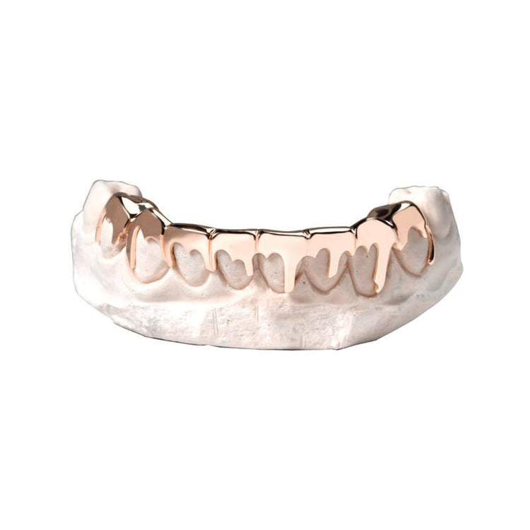 Gold Drip Grillz IF - Main Image