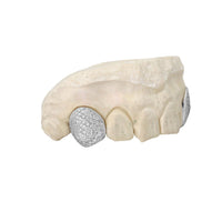 Grills - Diamond Grill Cap (Single) - ifandco.com